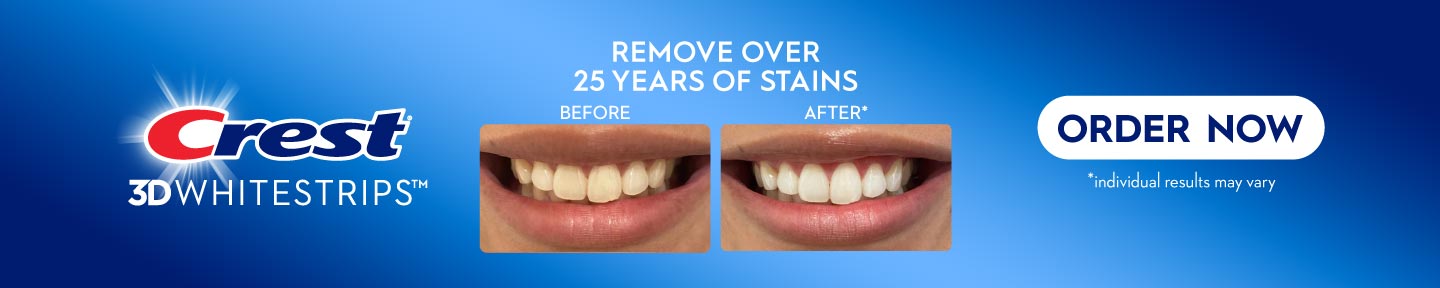 Crest Whitening Professional Exclusives